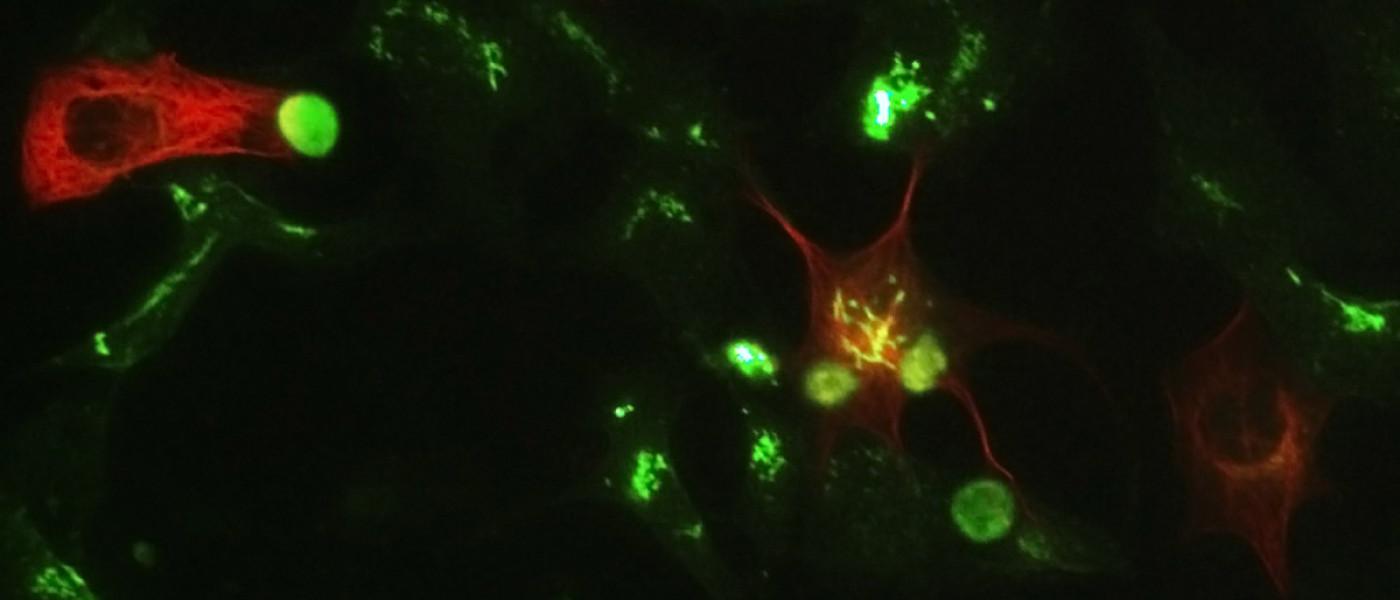 Various small cells as seen through a microscope